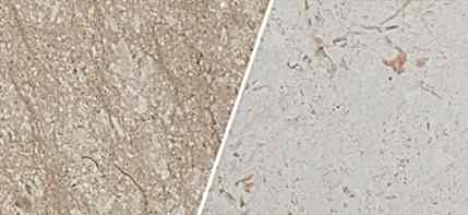 Limestone